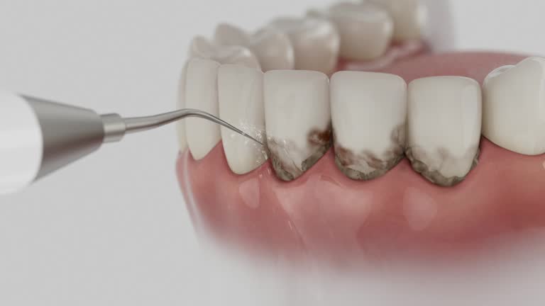 Reliable Emergency Dentist contractor in Duncan, SC by Smile Center Dentistry